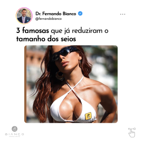 3-famosas-que-já-reduziram-o-tamanho-dos-seios-2a_01