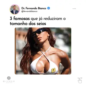 3-famosas-que-já-reduziram-o-tamanho-dos-seios-2a_01