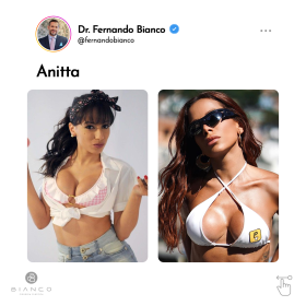 3-famosas-que-já-reduziram-o-tamanho-dos-seios-2a_02