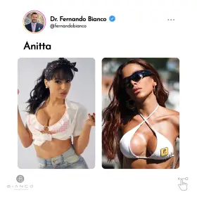 3-famosas-que-já-reduziram-o-tamanho-dos-seios-2a_02