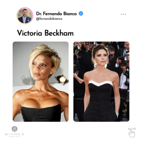 3-famosas-que-já-reduziram-o-tamanho-dos-seios-2a_03